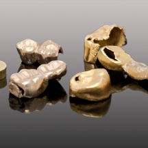 לוט של שיני זהב (כתרים מזהב 14 ו-18 קארט